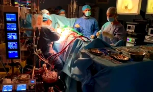 1 chirurgie cardiaca endoscopica b o c jpg jpeg