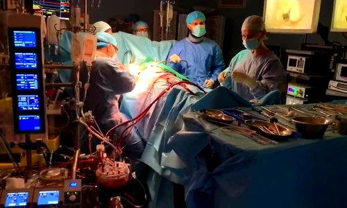 1 chirurgie cardiaca endoscopica b o c jpg jpeg