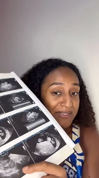 O femeie a rămas însărcinată de două ori în același timp FOTO: Instagram / Newsflash