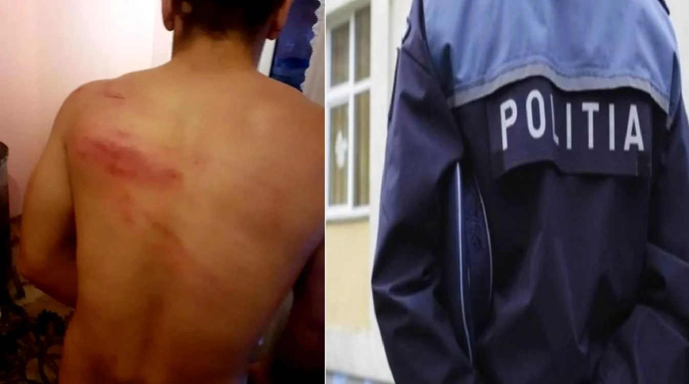 Rănile pe care un sibian susţine că i le-a provocat un şef de post cercetat acum pentru corupţie Foto colaj oradesibiu ro