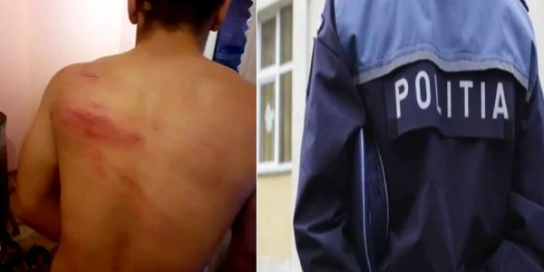 Rănile pe care un sibian susţine că i le-a provocat un şef de post cercetat acum pentru corupţie Foto colaj oradesibiu ro