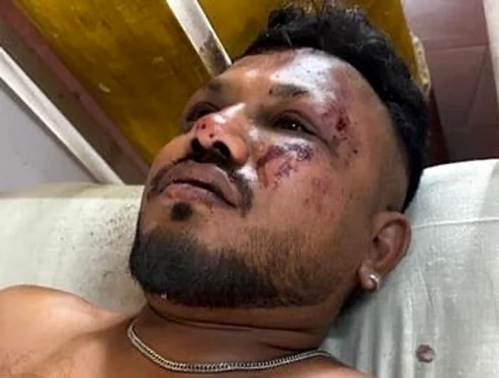Vishwashkumar Ramesh, singurul supraviețuitor al tragediei aviatice din India FOTO: X