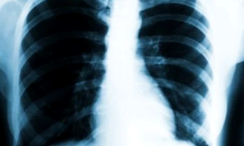 1 55935 original jpg jpeg