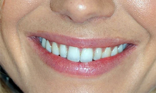 sienna miller mustata   top40 jpeg