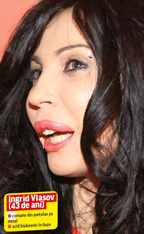 Şi Ingrid Vlasov are dinţi "falşi"