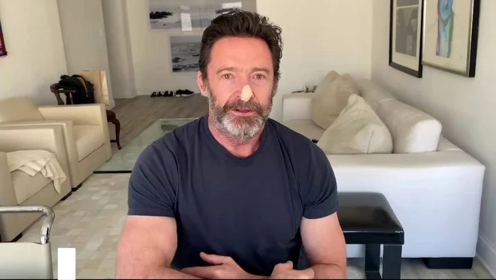 Hugh Jackman a fost suspect de cancer de piele (foto: captură video)