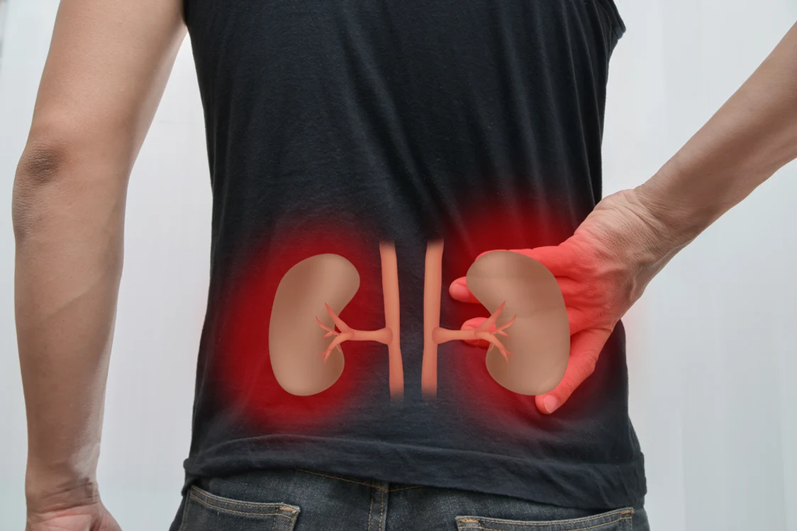 Experiența unui pacient diagnosticat cu două tumori renale