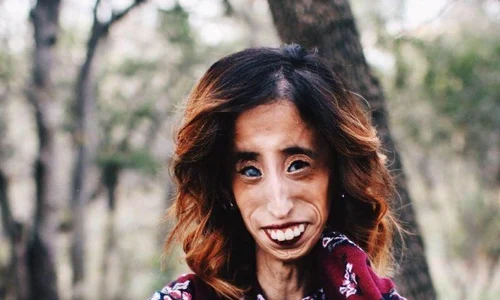 lizzie cea mai urata jpeg