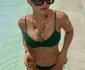 Carmen Grebenișan are probleme cu implanturile foto: Instagram
