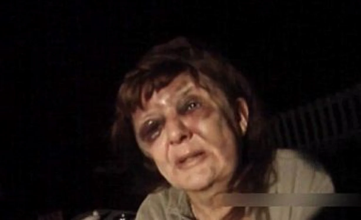 
    În momentul în care au intervenit oamenii legii, femeia era plină de vânătâi şi sângeraFoto: Daily Mail  