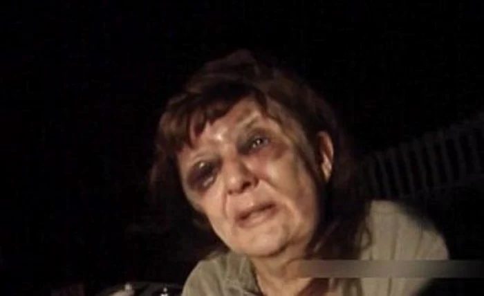 
    În momentul în care au intervenit oamenii legii, femeia era plină de vânătâi şi sângeraFoto: Daily Mail  