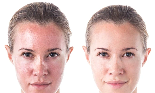 1 74854 original jpg jpeg