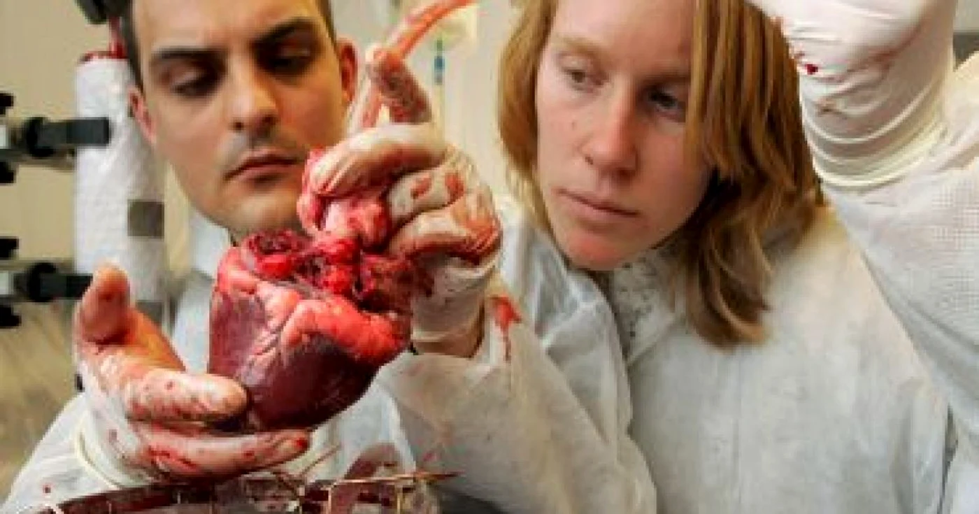 Premieră în medicină: folosirea unei inimi artificiale într-o operaţie