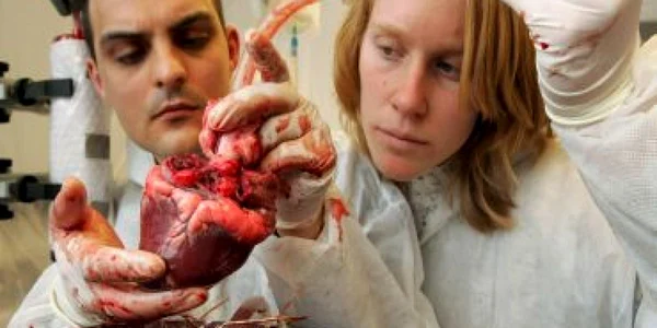 Premieră în medicină: folosirea unei inimi artificiale într-o operaţie