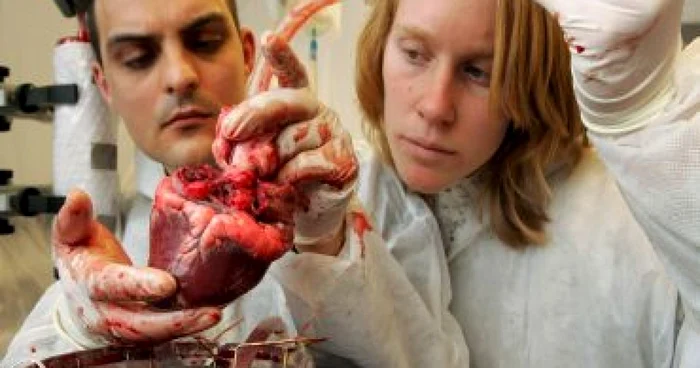Premieră în medicină: folosirea unei inimi artificiale într-o operaţie
