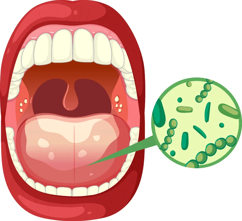 Igiena orală este foarte importantă în prevenția cancerului oral. FOTO: Shutterstock