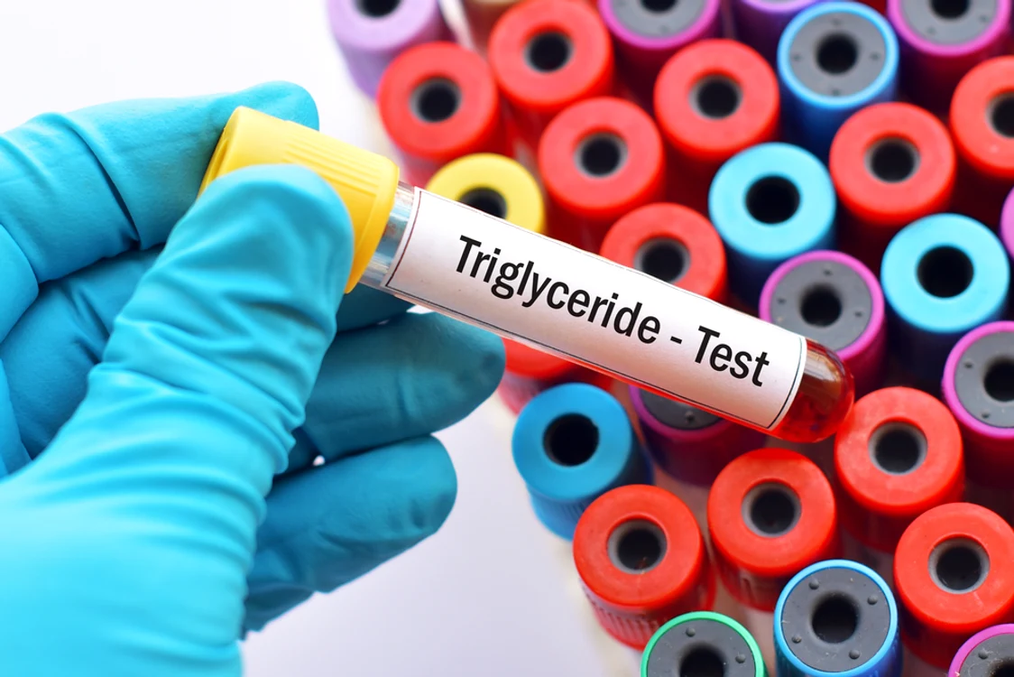 trigliceride jpg