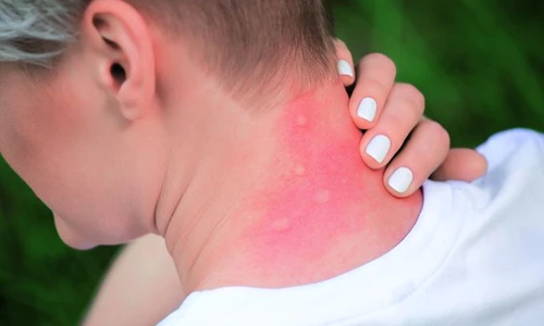 1 muscatura de tantar jpg jpeg