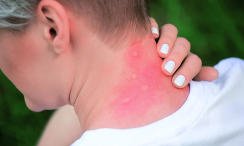 1 muscatura de tantar jpg jpeg