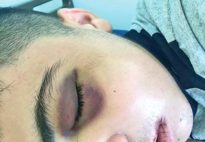 
    Golanul agresiv din Râmnicu Vâlcea îi cere socoteală profesoarei  