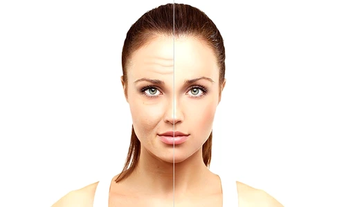 1 72059 original jpg jpeg