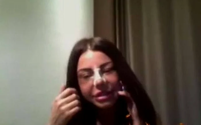 Roşcata le-a trimis colegilor poze cu ea după operaţie