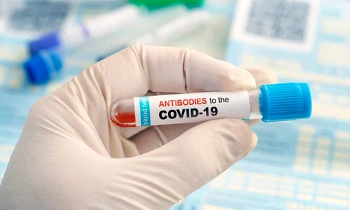 1 teste anticorpi jpg jpeg