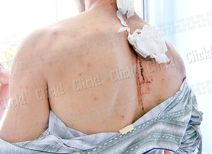 Agentul se află acum la spital, însă este în afara oricărui pericol (foto: Ionuţ Dima)