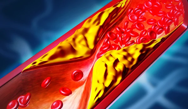 shutterstock 2690458617 jpg