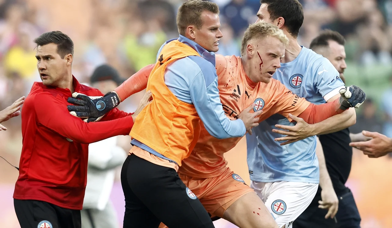 Portarul echipei gazdă a ajuns la spital (FOTO: Getty Images)