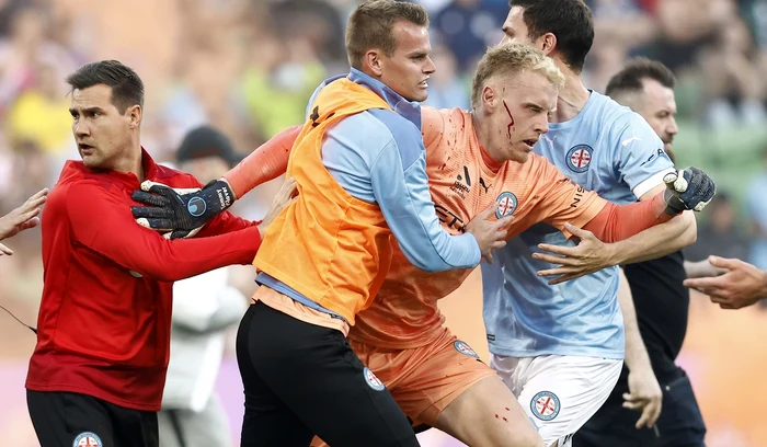 Portarul echipei gazdă a ajuns la spital (FOTO: Getty Images)