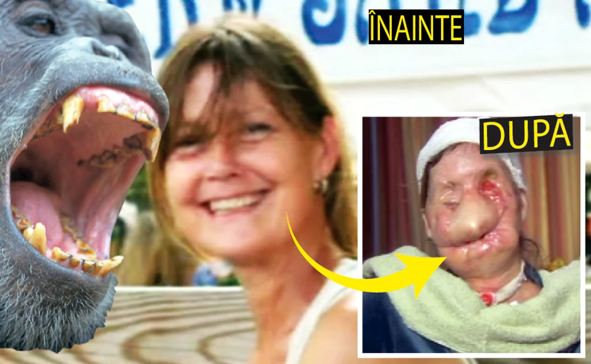 Femeia atacată de cimpanzeu e distrusă pe viaţă