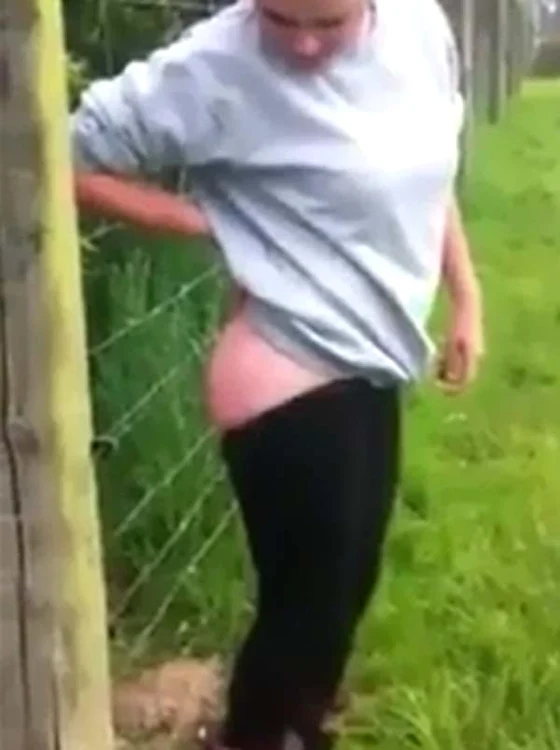 Şi-a pus fundul gol pe un gard electric