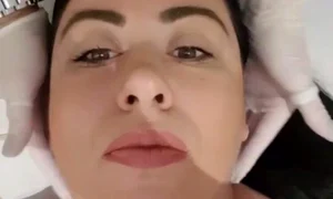 oana roman interventie estetica jpeg