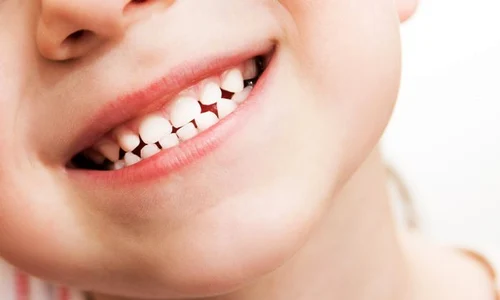 1 carii copii jpg jpeg