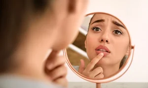 Ce sa nu faci cand ai buzele crapate Sursa foto shutterstock 1846727497 jpg