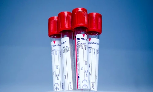 1 70894 original jpg jpeg