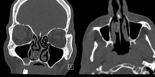 radiografie