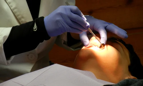 orthodontist 287285 1920 jpeg