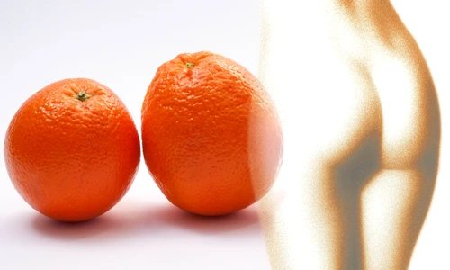 1 remedii celulita jpg jpeg