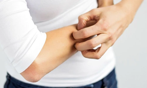 1 71845 original jpg jpeg