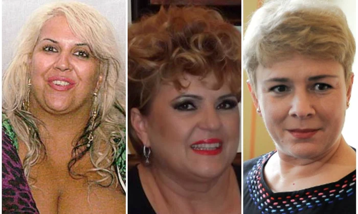 vedete care au facut operatie de micsorare a stomacului jpeg