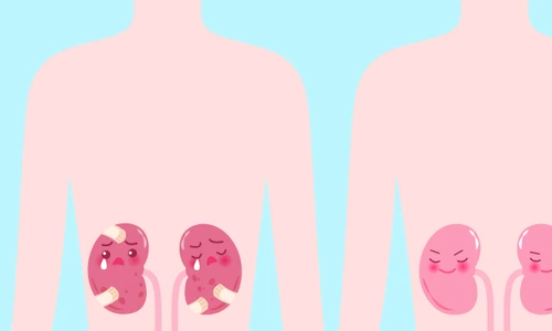 Semne care indica probleme cu rinichii  Sursa foto shutterstock 732643273 jpg