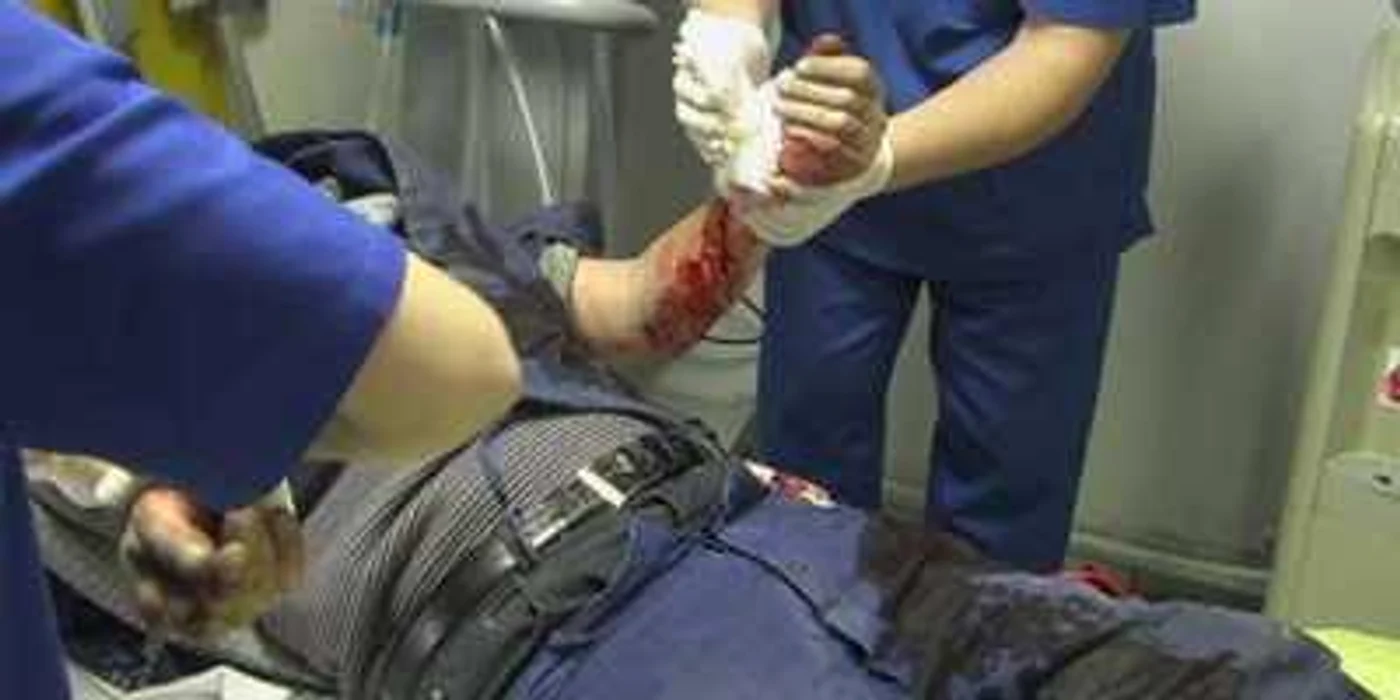 Bărbatul cu mâna tăiată de fai a primit imediat îngrijiri medicale