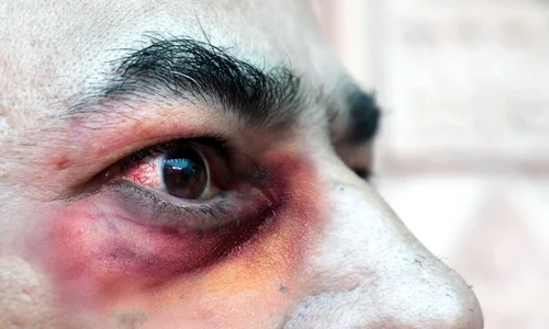 1 ciuperca neagra jpg jpeg