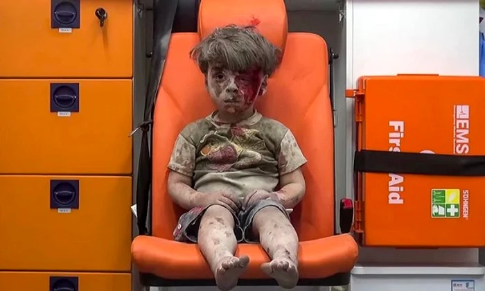 Omran Daqneesh, băiețelul de cinci ani care a impresionat o lume întreagă