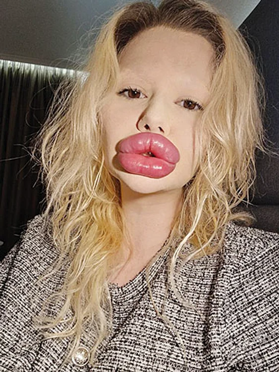 Andrea Ivanova  nu găseşte un dentist care  să îi trateze dintele spart. SURSĂ FOTO: PROFIMEDIA