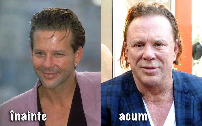 Katie Price arată ca un monstru din cauza de operații estetice, față de imaginea ei, inițială, care a făcut-o celebrfoto: GettyImages