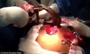 Operaţia şocantă a fost filmată şi apoi video ul a fost urcat pe Internet jpeg