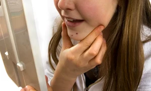 Punctele negre se scot doar la saloanele de cosmetică jpeg